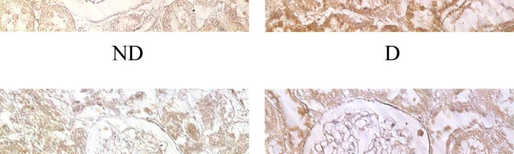 Representative IHC staining of renal TGF-β indicating increased TGF-β expression in