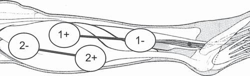 106 K. S. Centofanti Fig. 4.35 Calf recovery & rehabilitation pad layout Table 4.