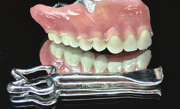 The sleep denture is milled from PMMA material and can be re-milled, if needed, without