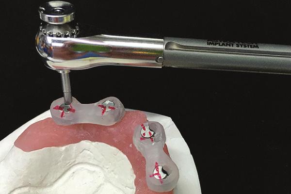 Call the lab for instructions if a Conus abutment does not transfer accurately from the model to the mouth.