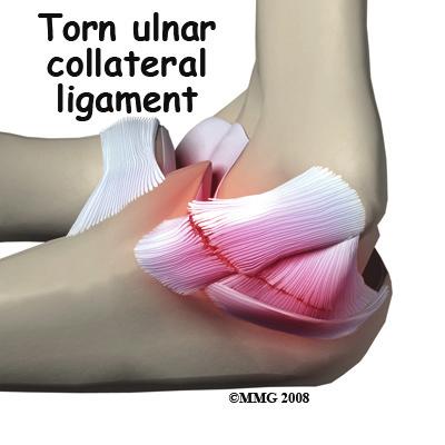 surrounds a joint and contains lubricating fluid called synovial fluid. at the end of the humerus. These ligaments are the main source of stability for the elbow.
