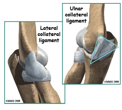 The ulnar collateral ligament can also be damaged by overuse and repetitive stress, such as the throwing motion. Causes What causes ulnar collateral ligament (UCL) injuries?