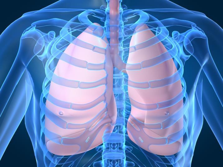Etiology of Restrictive Lung Disease Group of conditions characterized by
