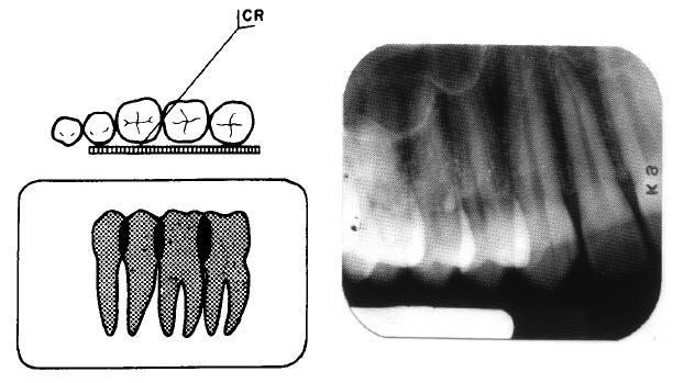 The dental specialist should be familiar with its techniques. The following paragraphs describe techniques using this method to produce a 14-exposure set of radiographs of an adult dentition.