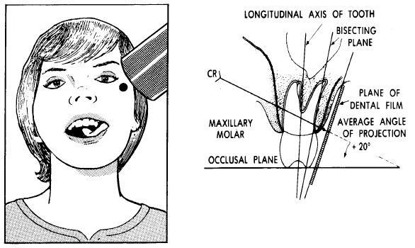 Figure 4-10. Maxillary molar area. 4-11. MAXILLARY BICUSPIDS Adjust the head as described for radiographs of maxillary teeth.