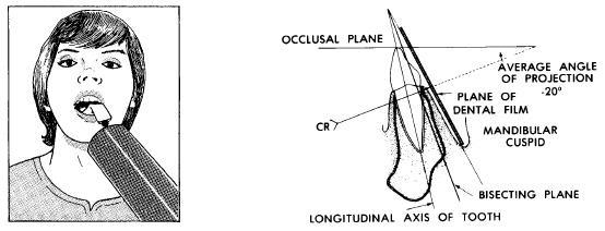 Figure 4-16. Mandibular cuspid area. 4-17. MANDIBULAR INCISORS Adjust the head as described for radiographs of mandibular teeth. Place the film packet in the mouth with the long axis vertical.