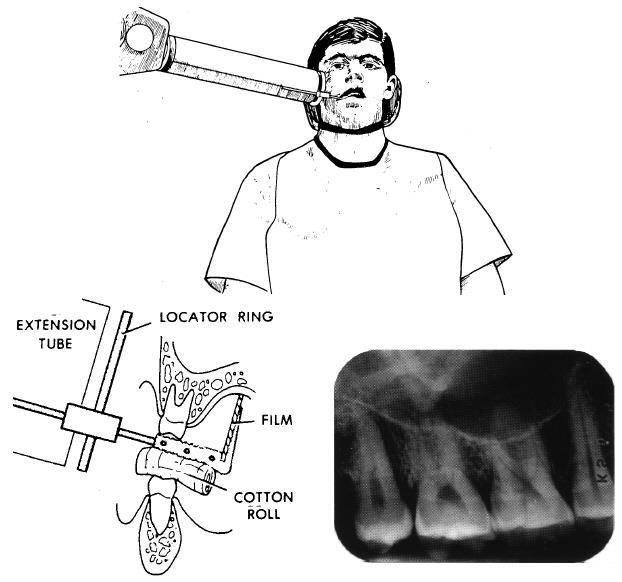 Figure 4-21. Maxillary molar area. 4-21. MAXILLARY BICUSPIDS Position the posterior instrument assembly in the patient's mouth with the bicuspids centered on the film parallel to the long axis of the teeth (see figure 4-22).
