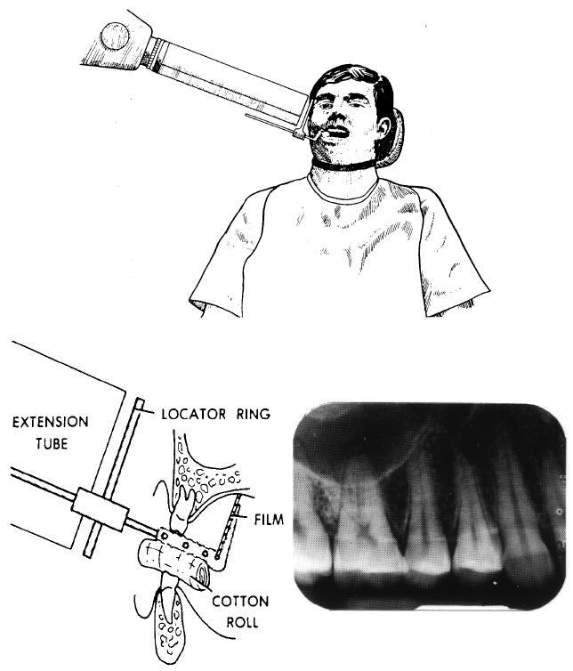 Figure 4-22. Maxillary bicuspid area. 4-22. MAXILLARY CUSPIDS Using the anterior instrument assembly, position the cuspid tooth on the film parallel to the long axis of the tooth and center it (see figure 4-23).