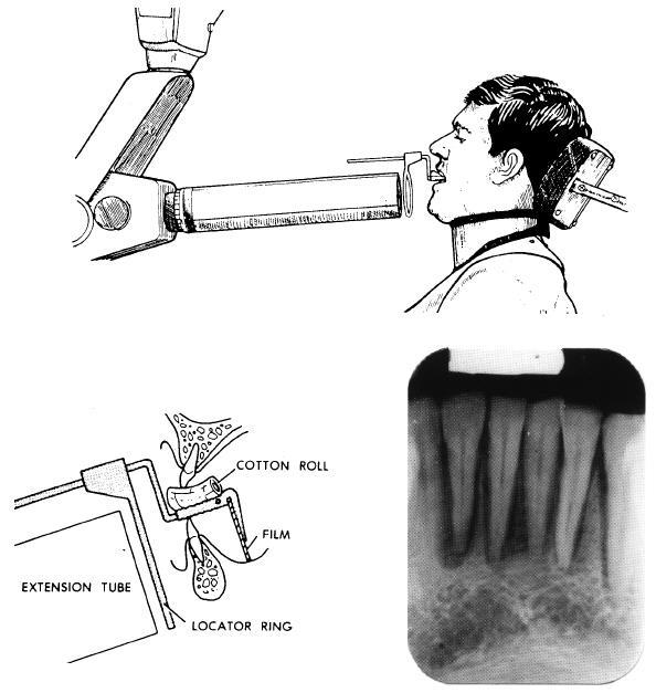 Figure 4-28. Mandibular incisor area.