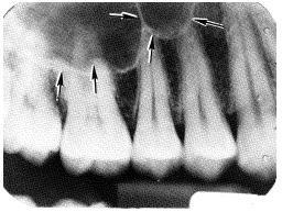 b. Disposition of Radiographs. Some radiographs may be kept for extended periods if the dentist deems necessary. These radiographs may serve as history with regard to future treatment of the patient.