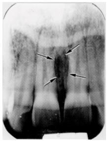 Knowledge of the location and normal appearances of these landmarks is important in identification and orientation of radiographs.