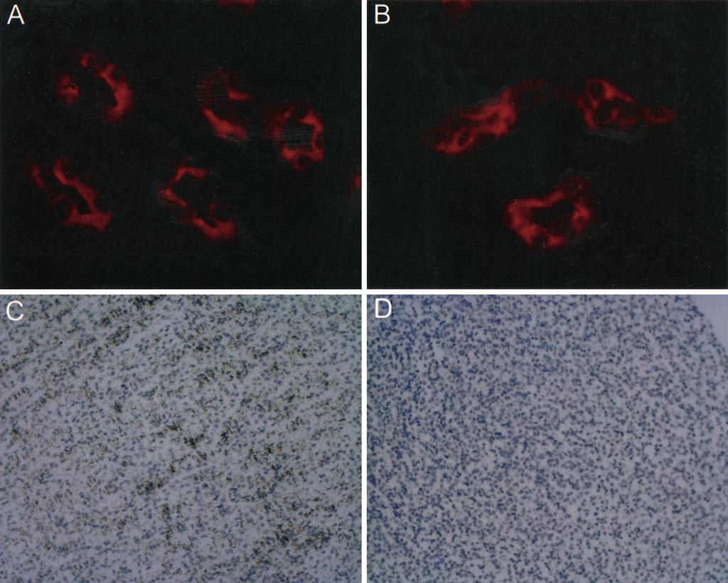 TGF- 1 Induced Nephropathy Figure 4. The expression of aquaporin-2 (AQP-2) in the inner medulla of a 3-month-old transgenic (A) and nontransgenic (B) mouse ( 1000).