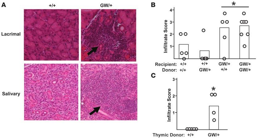 Figure 2 Aire GW/+ mice (mixed C57BL/6-129 background) develop spontaneous autoimmune disease that is thymus dependent.