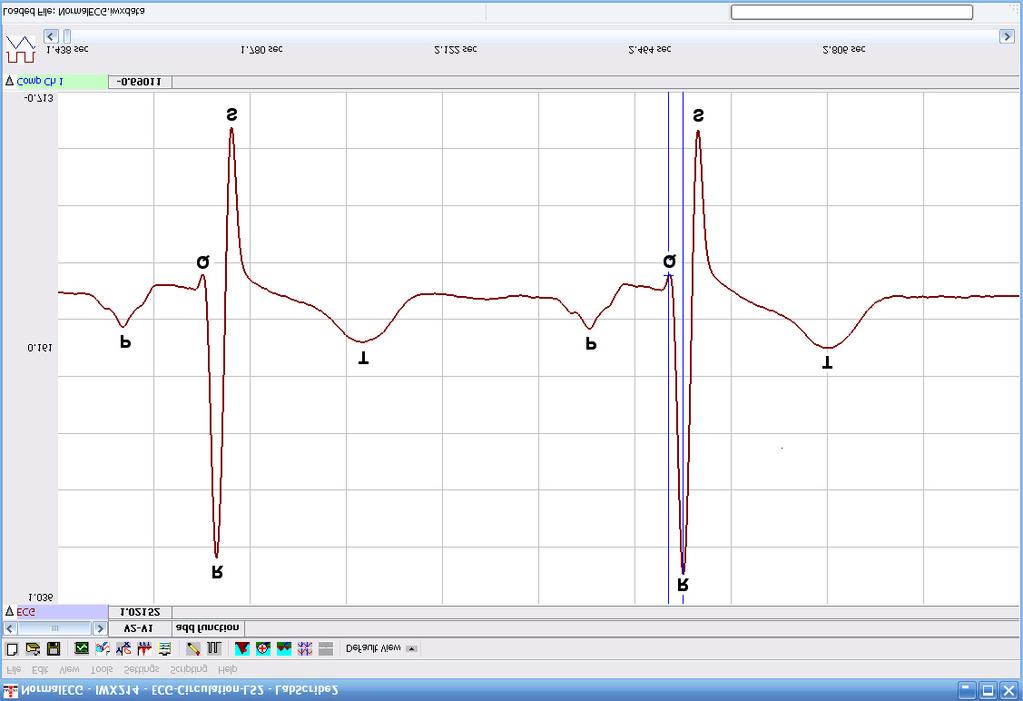 Figure HH-4-B1: ECG trace in the Main window with labels showing the P, QRS and T waves.