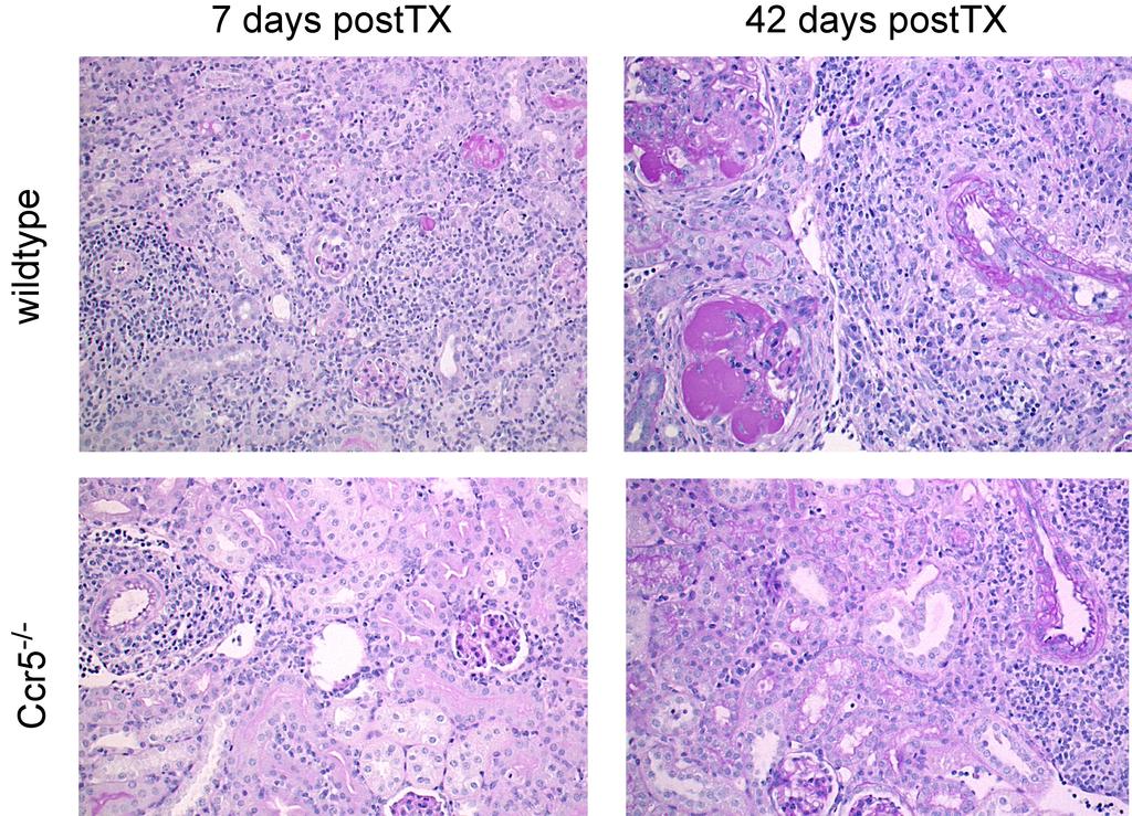 3 - RESULTS Figure 15. Effects of chemokine receptor deficiency on the histology of renal allografts.