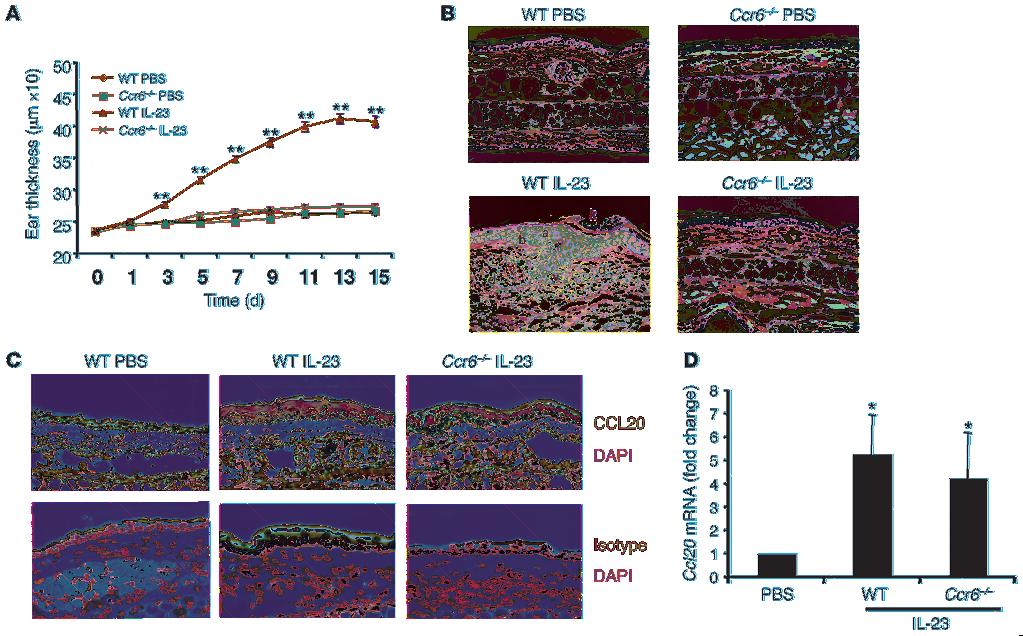 Figure 1 Ccr6 / mice are resistant to IL-23 induced acanthosis and dermal inflammation.