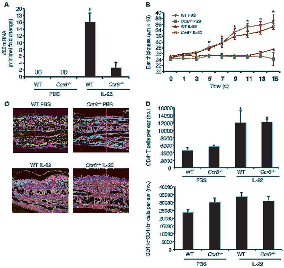 Figure 3 IL-22 production deficiency is the critical factor in protection against psoriasis-like changes in Ccr6 / mice.