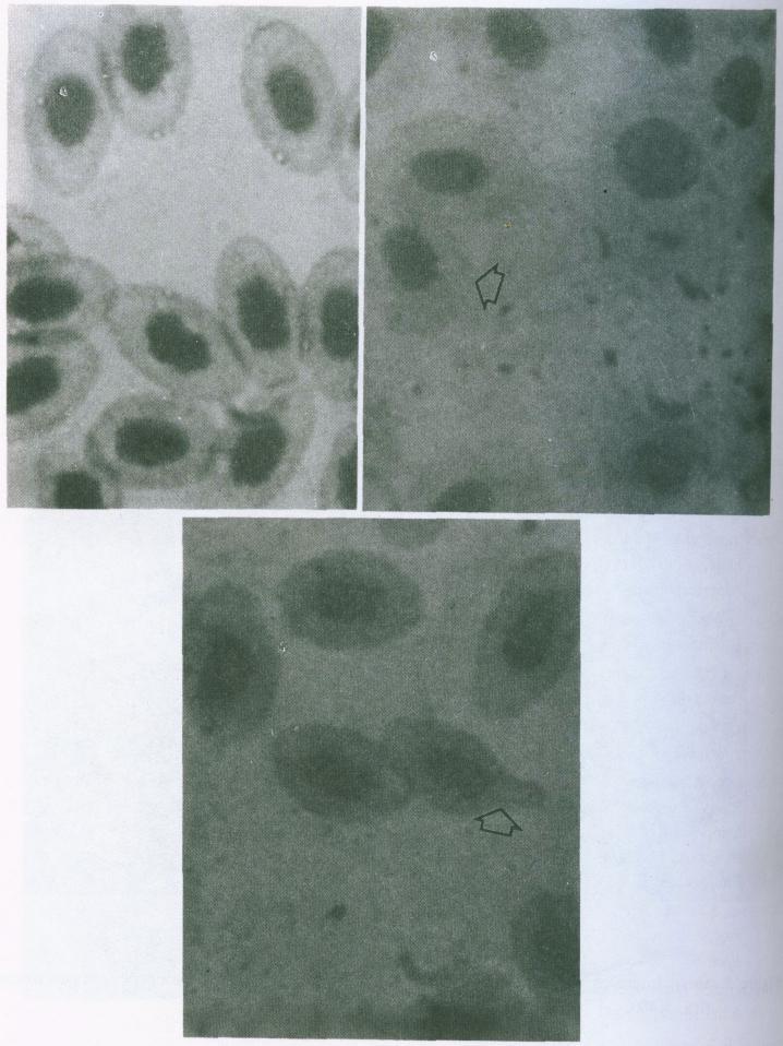 BIOTROPIA No. 6, 1992/1993 Figure 9. Blood smear from a contol Tilapia nilotica; b.