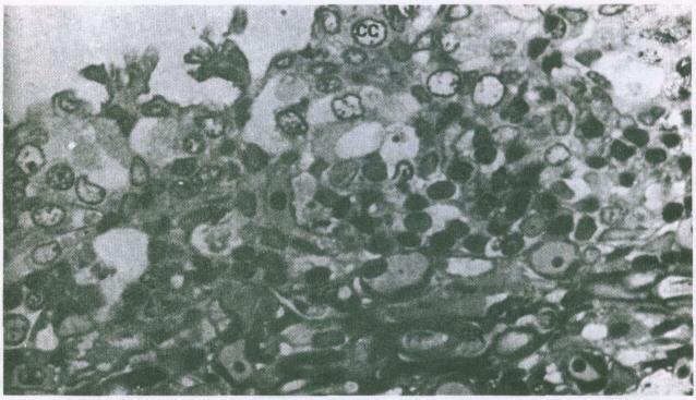 Effects of the heavy metal, zinc, on Tilapia nilotica L. - V.S. Carino Figure 3.