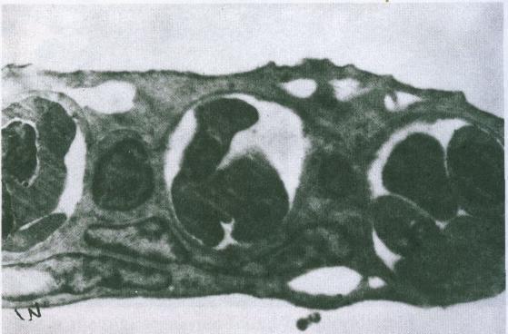 BIOTROPIA No. 6, 1992/1993 Hypertrophy of secondary gill epithelia has been reported as a response of fish to industrial pollutants. Hughes et al.