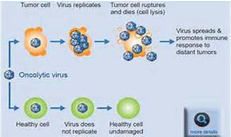 Talimogene Laherparepvec (TVEC) Intratumorally delivered Oncolytic immunotherapy Herpes virus that selectively replicates in solid tumors Deletion of HSV 1 viral genes encoding ICP34.