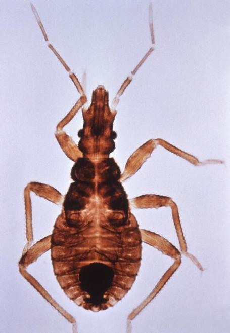 Chagas Disease (Trypanosoma cruzi) Riduviid bug which carries T. cruzi (the parasite that causes Chagas disease) Chagas disease is caused by infection from a parasite called Trypanosoma cruzi (T.