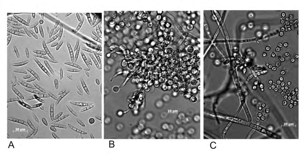 Journal of Plant Pathology (2010), 92 (1), 7-18 T. Yli-Mattila 11 Fig. 1. Light microscope view of Fusarium conidia. A. F. sporotrichioides, B. F. langsethiae, C. F. poae (photos by Tatiana Gagkaeva).