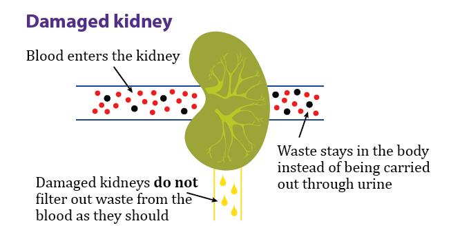 permanent damage to the kidneys