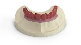 Atlantis Hybrid Intended for screw-retained prosthesis, commonly used for acrylic denture teeth with individual support for each tooth, as a wraparound or a wrap-on solution. Bridge Screw EV M1.