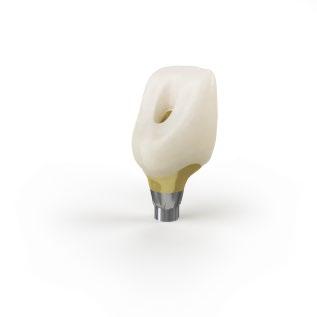 biteforces are expected it is recommended to select a titanium abutment if possible. CastDesign EV should primarily be regarded as an abutment used when no titanium option is available.
