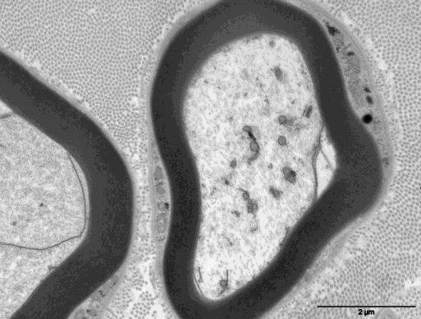 (C), abnormally shaped mitochondria (black