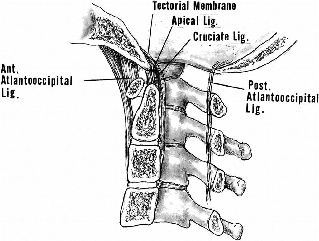 VERTEBRAL COLUMN INJURY (SPECIFIC INJURIES) TrS9 (2) if ligamentum flavum buckles into spinal cord central cord syndrome.