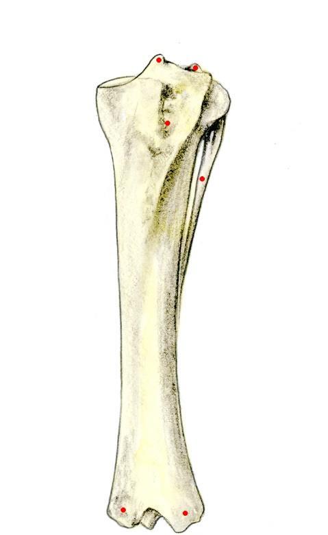 Patella The patella, a sesamoid bone that sits near the distal end of the femur, is