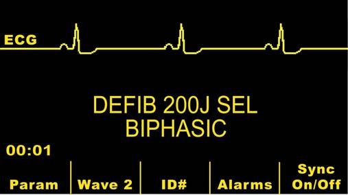 OPTION INSERT Defibrillator Function The M Series Rectilinear Biphasic Waveform Defibrillator Option is a DC defibrillator capable of delivering up to 200 joules of energy.