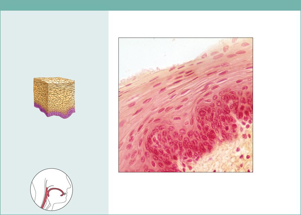 (e) Stratified squamous epithelium Description: Thick membrane composed of several cell layers; basal cells are cuboidal or columnar and metabolically active; surface cells are flattened (squamous);