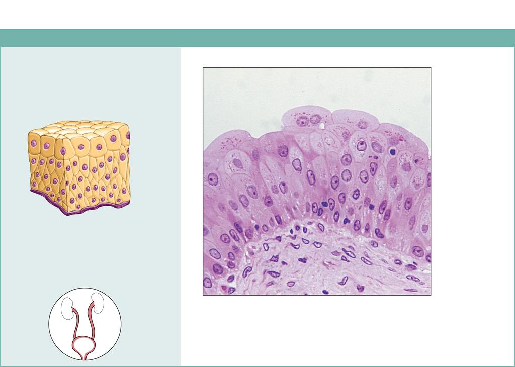 (f) Transitional epithelium Description: Resembles both stratified squamous and stratified cuboidal; basal cells cuboidal or columnar; surface cells dome shaped or squamouslike, depending on degree