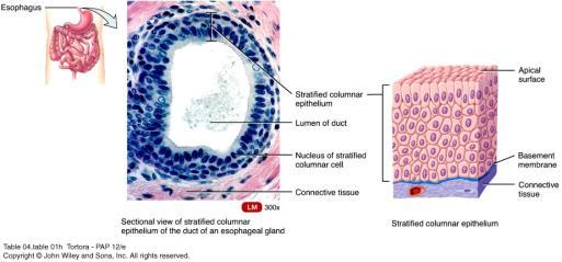 epithelium Also very uncommon Columnar cells in apical layer only Basal