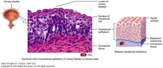 Transitional Epithelium Found only in the urinary system Variable appearance In relaxed