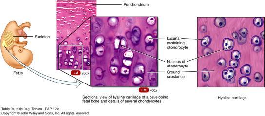 Hyaline cartilage Most abundant cartilage in the body Surrounding by perichondrium (some