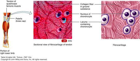 Reduces friction Fibrocartilage Chondrocytes are scattered among bundles of collagen fibers