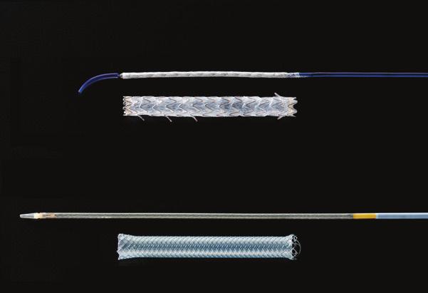 1 Precise delivery New short wire delivery system Combined short wire delivery system and stent flexibility provides accurate delivery with optimal positioning and deployment.