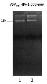 Electrophoresis results showed that the fragment sizes of extracted plasmids with marker plasmids were identical, indicating the successful extraction of these plasmids from bacterial cultures. 16.