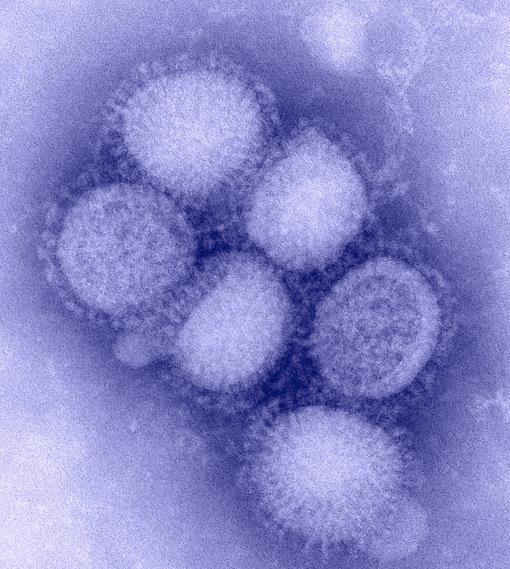H1N1 2009