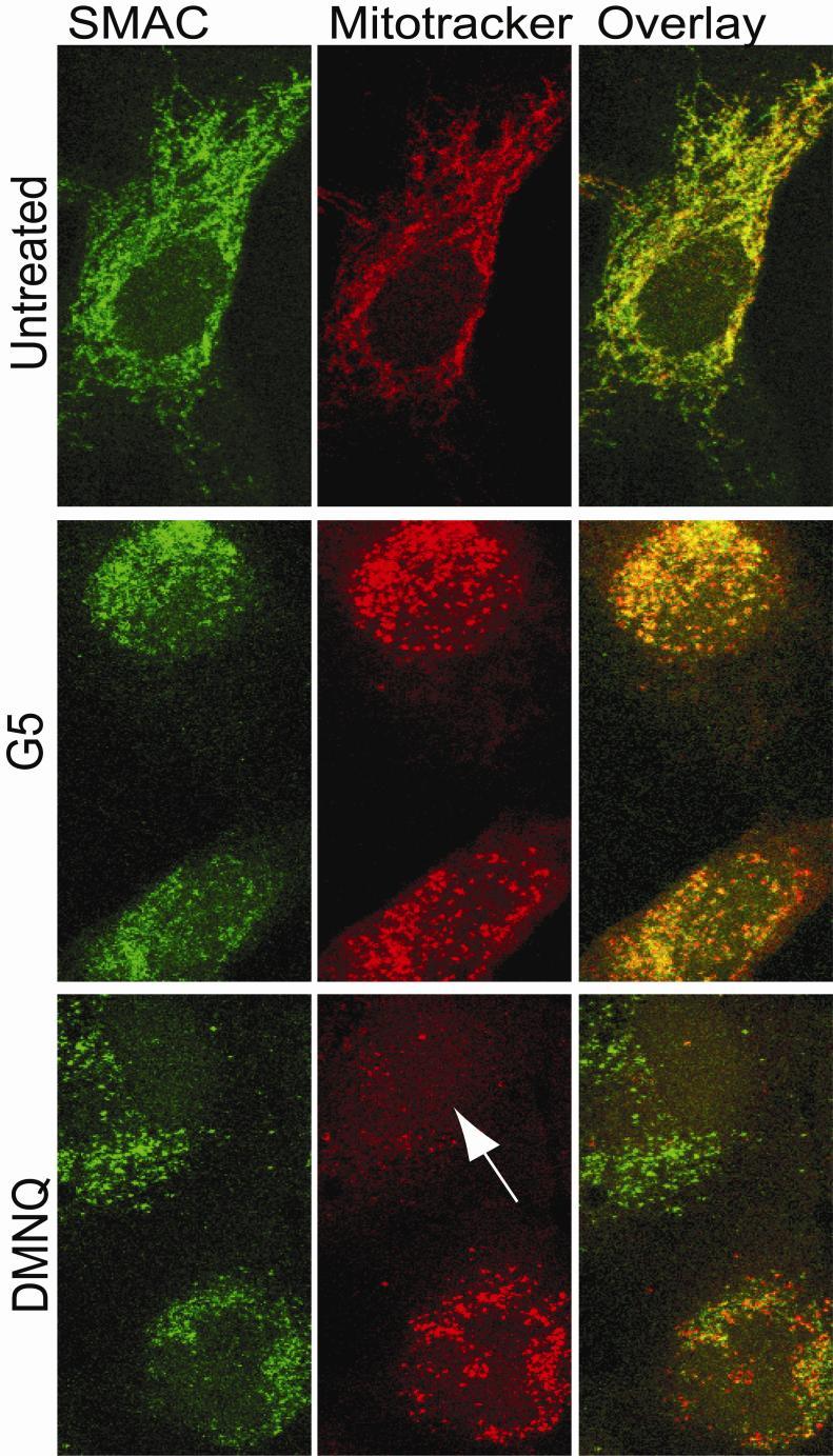 Figure 14. Mitochondrial fragmentation without MOMP in U87MG/Bcl-xL cells.
