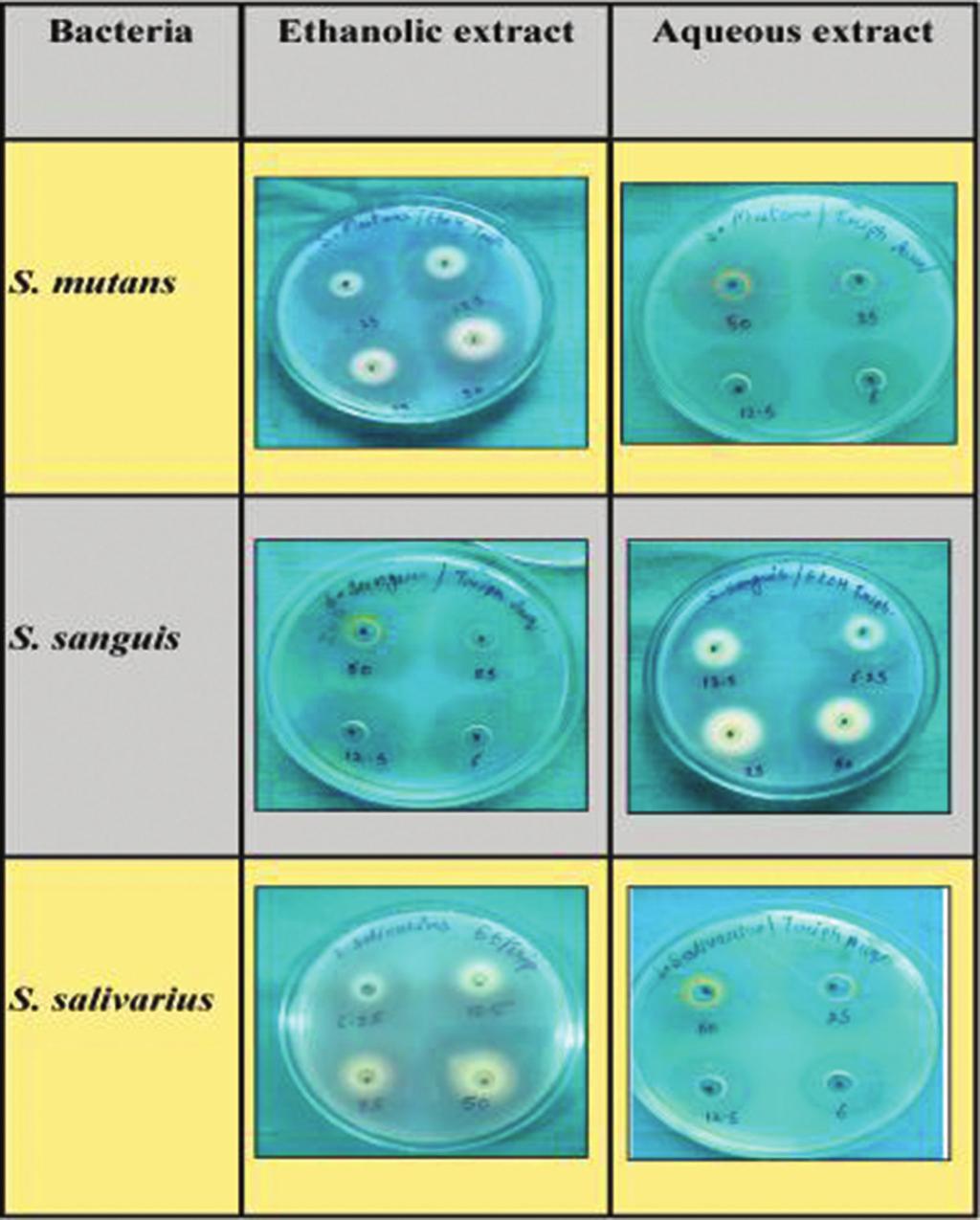 Figure 1: Mean diameter of inhibition zone by ethanolic and aqueous s of Triphala on Streptococcus mutans, Streptococcus sanguis and Streptococcus salivarius could be attributed to methodological