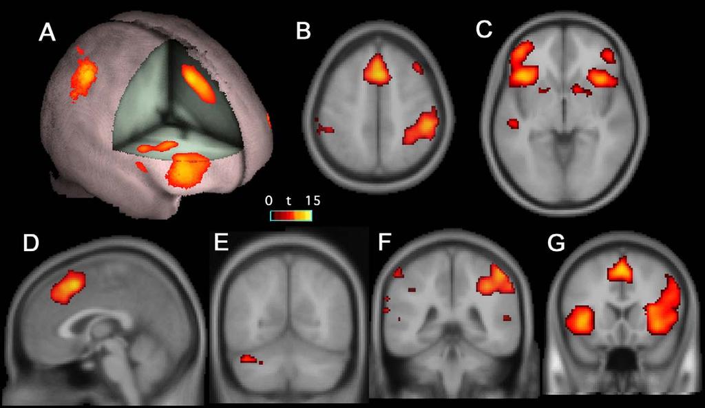 4 A.C. Livesey et al. / Neuropsychologia xxx (2006) xxx xxx Fig. 1. Imaging data obtained from Experiment 1.