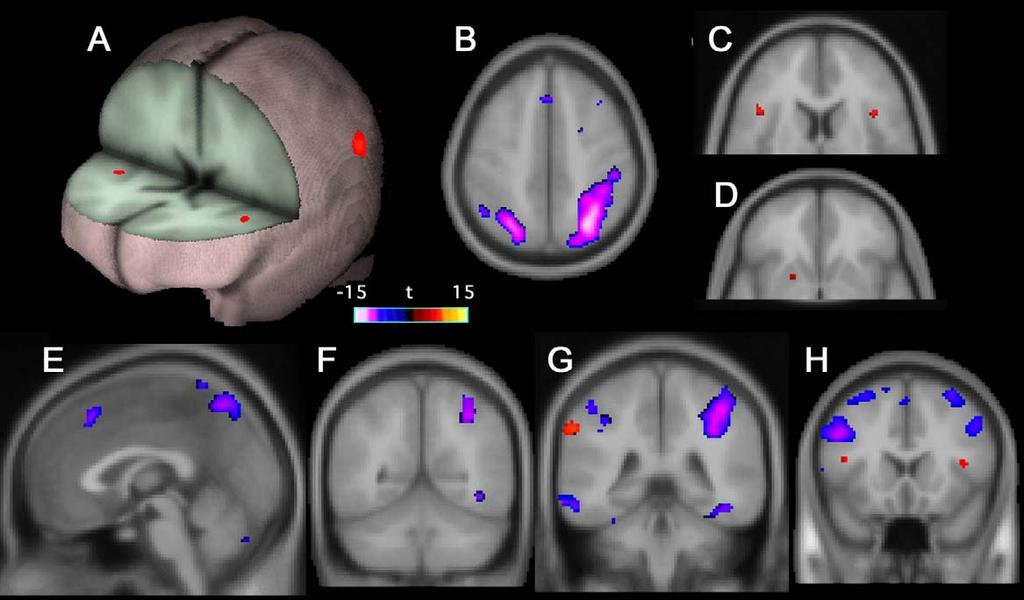 A.C. Livesey et al. / Neuropsychologia xxx (2006) xxx xxx 5 Fig. 2. Imaging data obtained from Experiment 2. The data are again from a group analysis and are thresholded at p < 0.01 (FDR corrected).