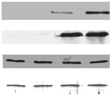 The interaction between fragments and AdipoR amino terminus (NT) in EGY48 (p8op lacz) yeast cells was examined by β-galactosidase filter assays.