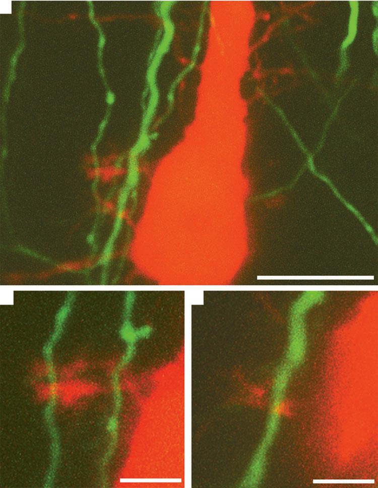 neurons into the extrellulr spe.