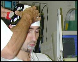 The Restore Study (rtms) Brain Stimulation repetitive Transcranial Magnetic Stimulation Results: Terrific!